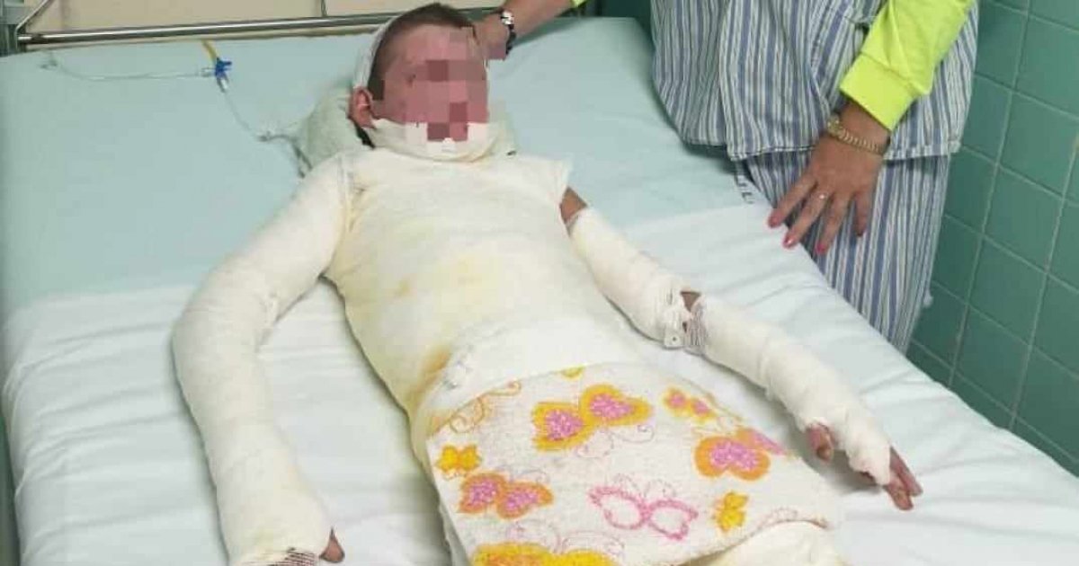 Fotografía de archivo de Leandro en una cama del hospital, con vendajes y el rostro pixelado.